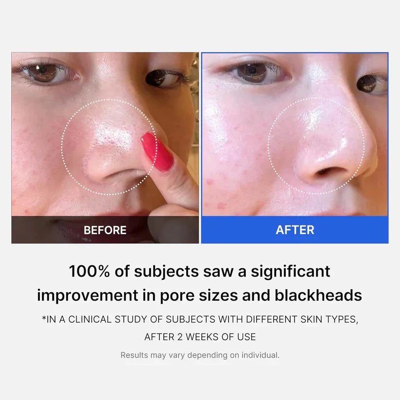 Medicube Zero Pore Pads 2.0 | 70 almofadas - imagem 3