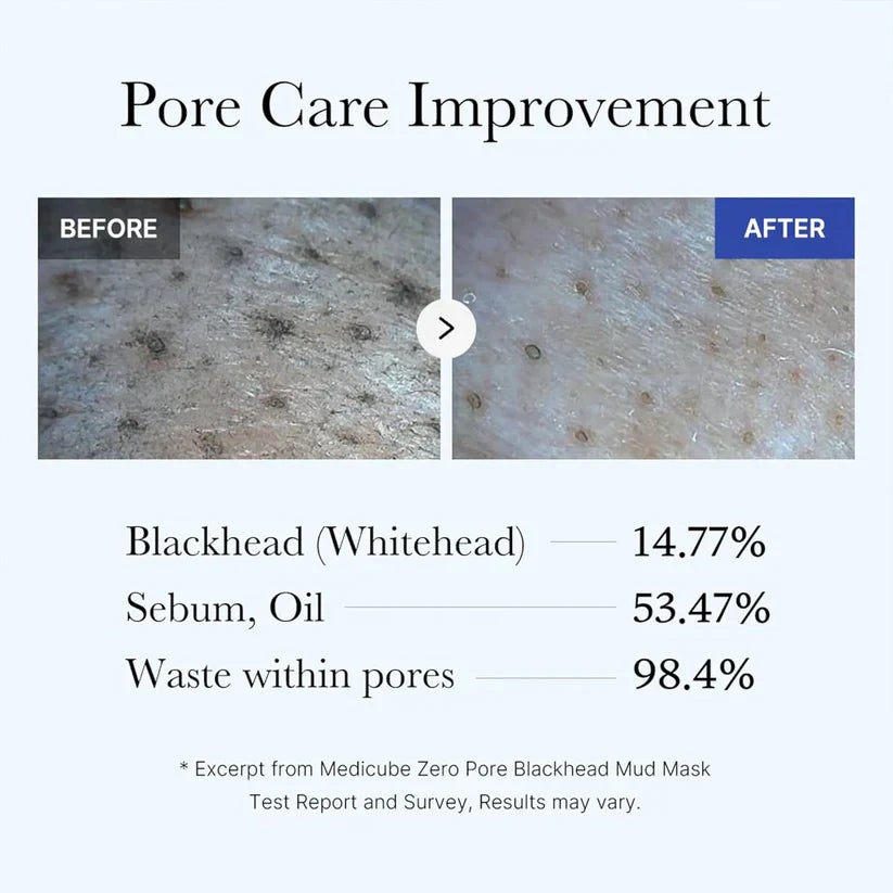 Máscara facial de lama Medicube Zero Pore Blackhead - imagem 4