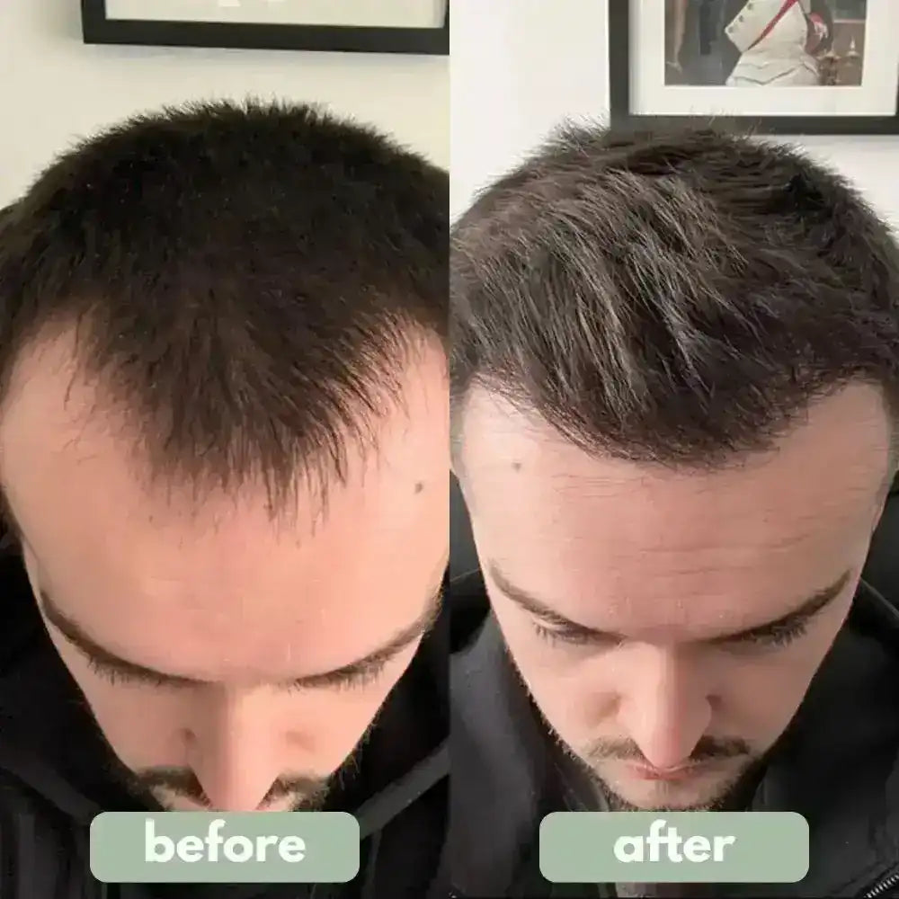 Be BodyWise - Hair Growth Serum - foto 3