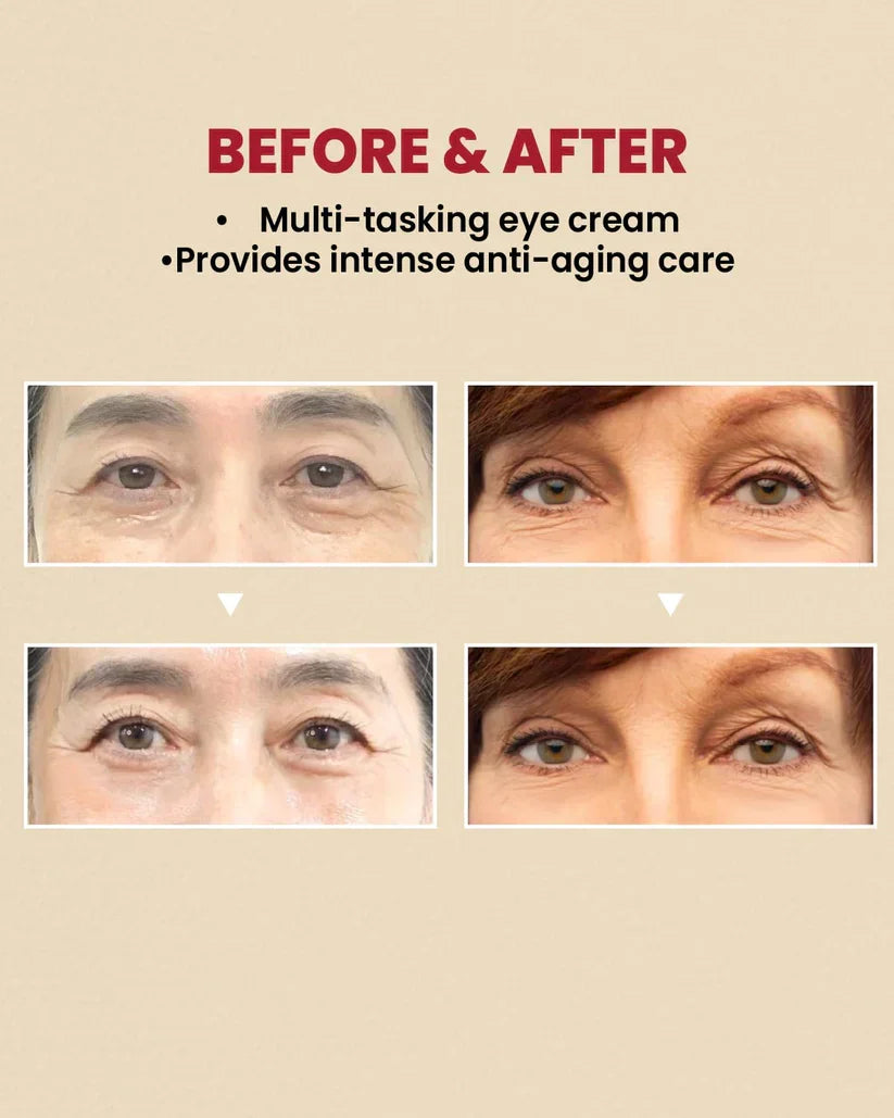 Creme para os olhos K SECRET SEOUL 1988: Lipossoma Retinal 4% + Feijão Fermentado - imagem 3