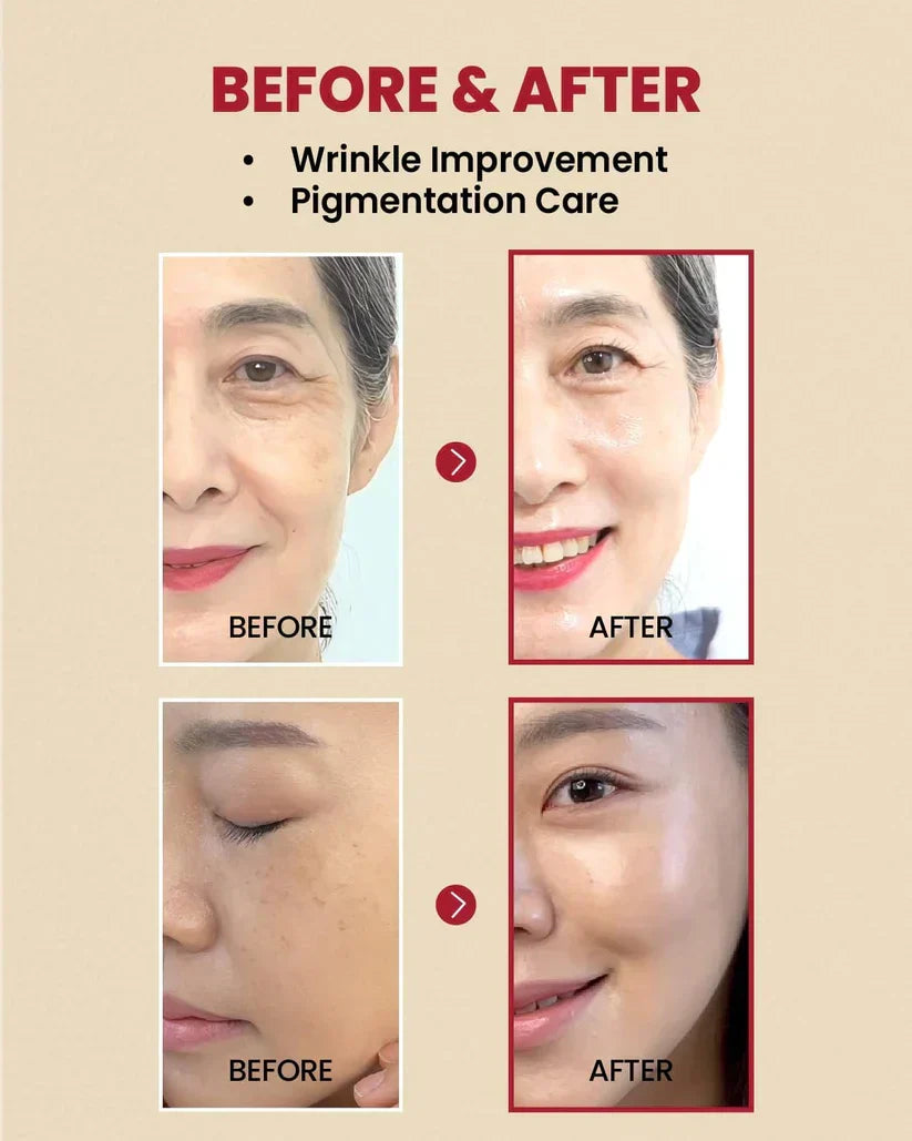 Soro K SECRET SEOUL 1988: Lipossoma Retiniano 2% + Ginseng Preto - imagem 2
