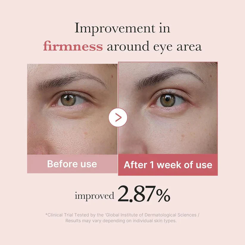Medicube Sérum para os Olhos PDRN Pink Peptide 30 ml - imagem 5
