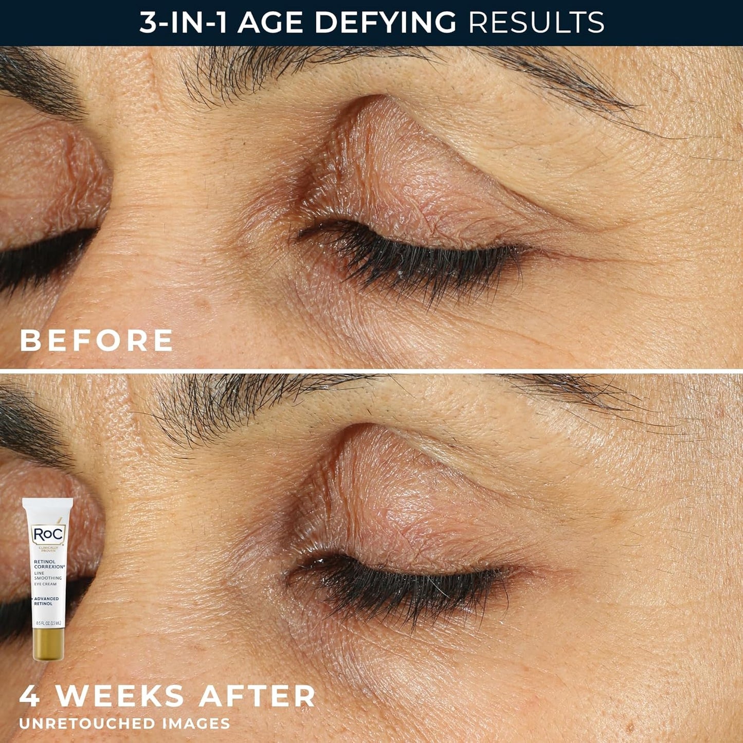Duo Reparador Diário de Retinol - imagem 4