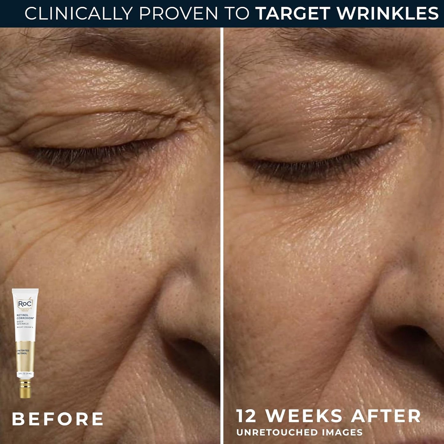 Duo Reparador Diário de Retinol - imagem 5