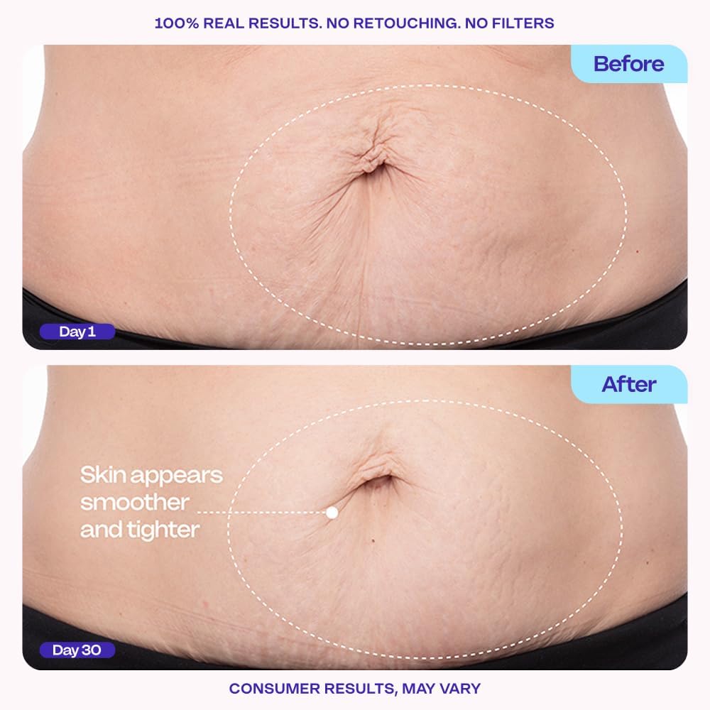 Creme para Barriga CoreFirm - imagem 3