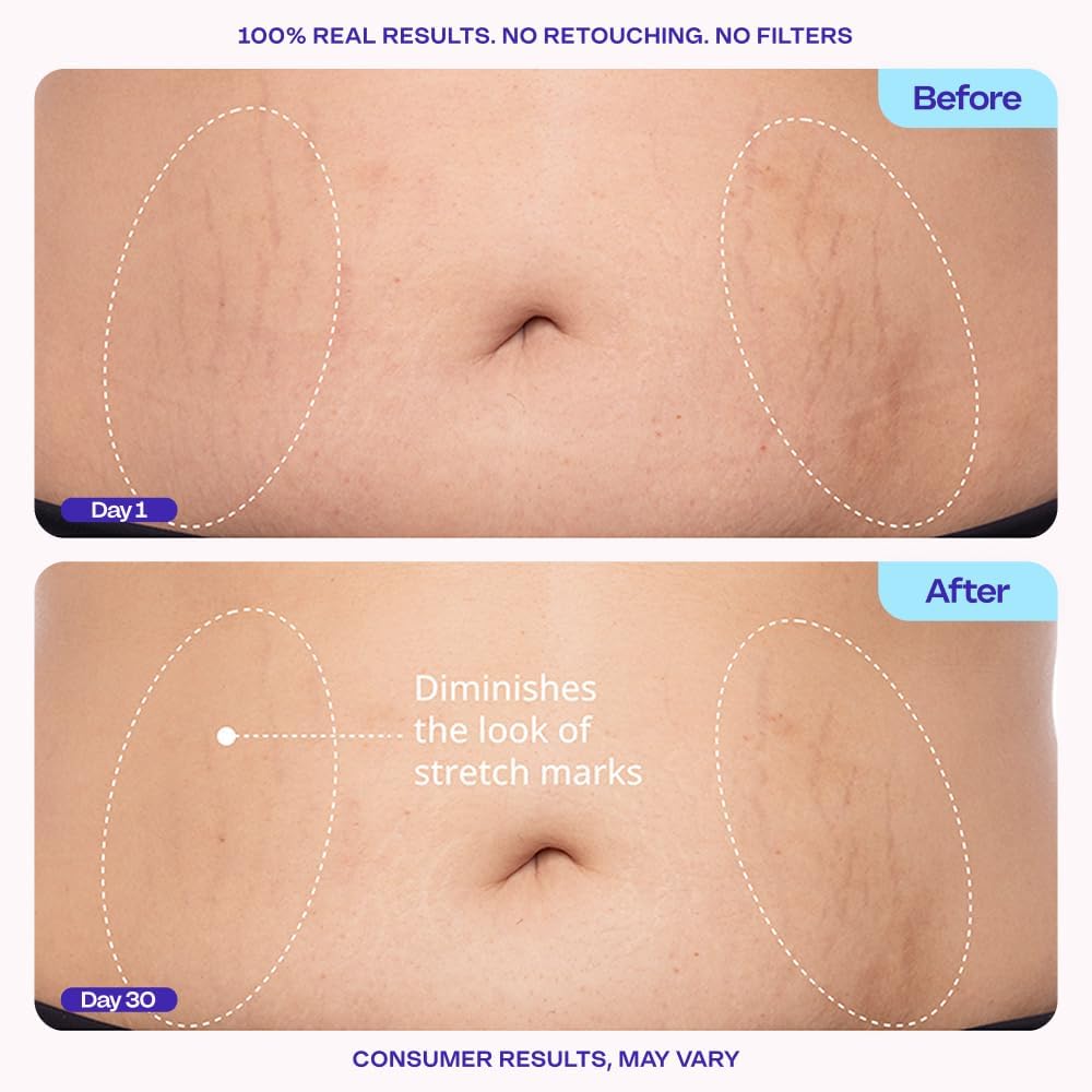 Creme para Barriga CoreFirm - imagem 5